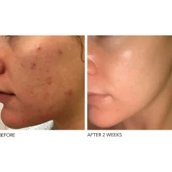 Alpha Beta® Extra Strength Daily Peel 30 Pack