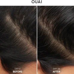 Antidandruff Shampoo