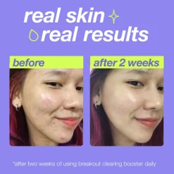 Breakout Clearing Booster