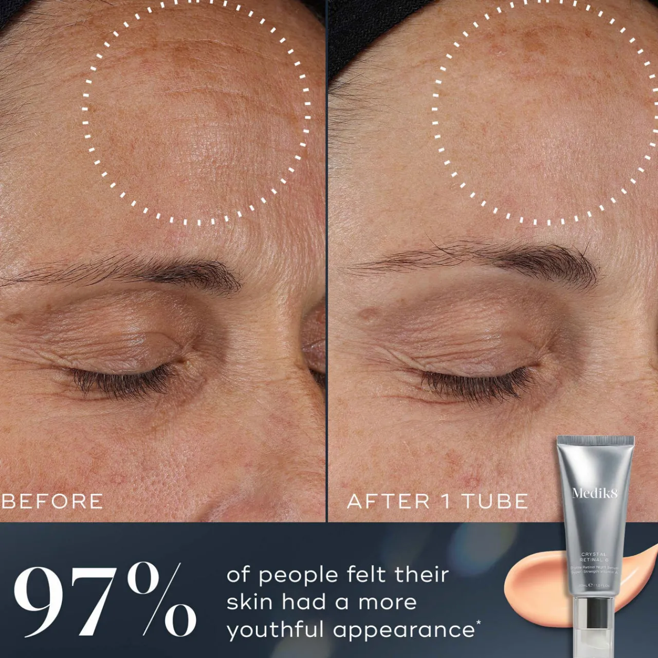 Online MEDIK8 Crystal Retinal 10