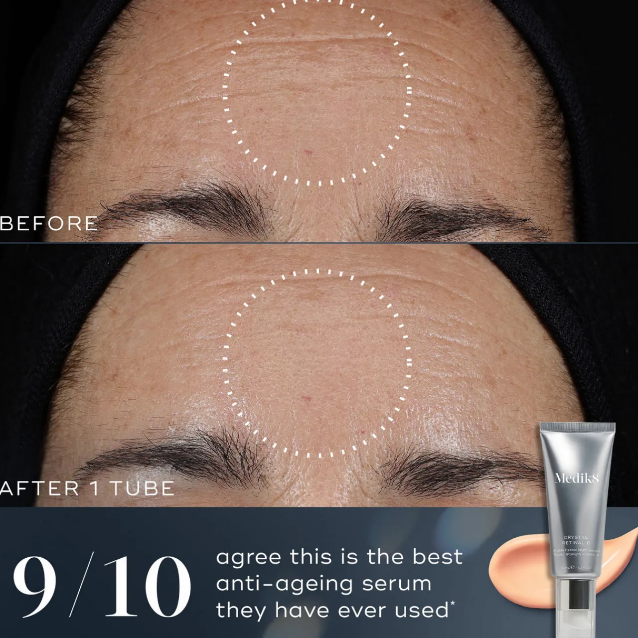 Best MEDIK8 Crystal Retinal 6