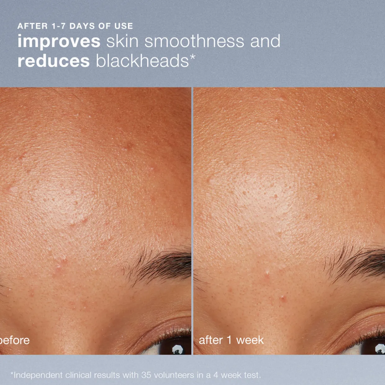 Dermalogica Daily Microfoliant