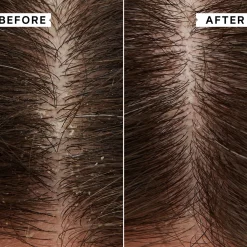 Flaky-Itchy Scalp Hydrating Conditioner