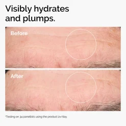 Hyaluronic Acid 2% + B5