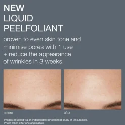Liquid Peelfoliant
