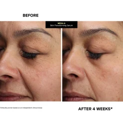 Mega-A Skin Transforming Serum