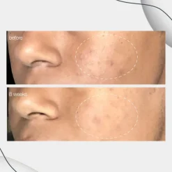 Discount DERMALOGICA Powerbright Dark Spot Corrector