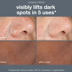 Outlet DERMALOGICA Powerbright Dark Spot Peel