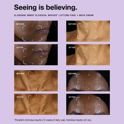 Online CLINIQUE Smart Clinical Repair™ Lifting Face + Neck Cream