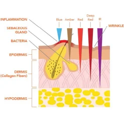 SpectraLite™ FaceWare Pro