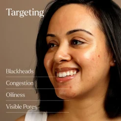 Sale SKIN ROCKS The Control Acid