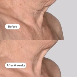 Discount TRINNY LONDON The Elevator Neck + Décolleté Concentrate