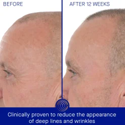 Discount AUGUSTINUS BADER The Retinol Serum