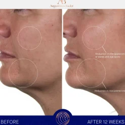 New AUGUSTINUS BADER THE RICH CREAM