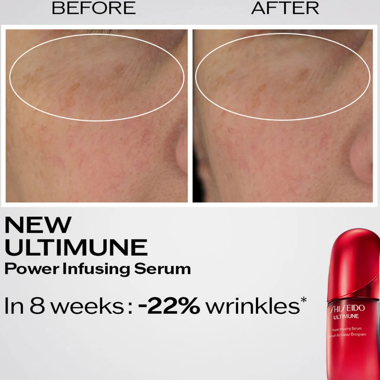 Hot SHISEIDO Ultimune Power Infusing Serum